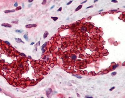 Anti-Band 3 / AE1 (N-term) Antibody