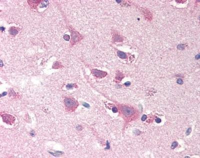 Anti-SMOC2 (N-term) Antibody