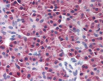 Anti-SIK2 Antibody