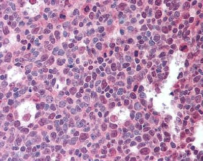 Anti-BAFF Antibody