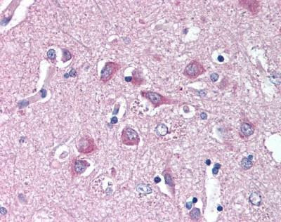 Anti-WNT14 / WNT9A (N-term) Antibody
