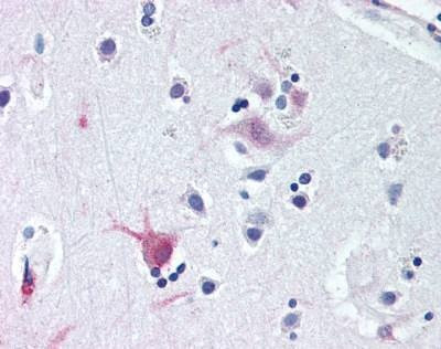 Anti-WNT8B / Wnt 8b (C-term) Antibody