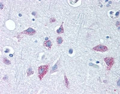 Anti-WNT8B / Wnt 8b (Internal) Antibody