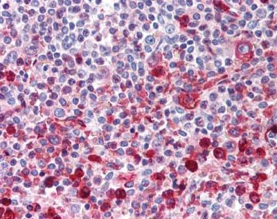 Anti-WNT16 (Internal) Antibody