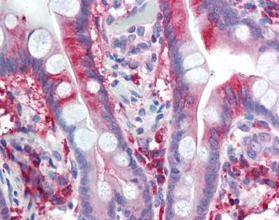 Anti-CACNA1C / Cav1.2 (Internal) Antibody