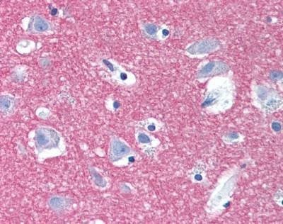 Anti-STX1A / Syntaxin 1A (Internal) Antibody