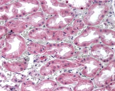 Anti-GPC4 (Internal) Antibody
