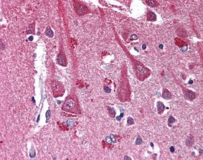 Anti-CXCR4 Antibody