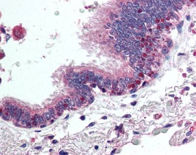 Anti-HDAC4 (aa194-209) Antibody