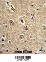 Anti-BECN1 (Ascites) Antibody