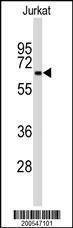 Anti-BECN1 (Ascites) Antibody