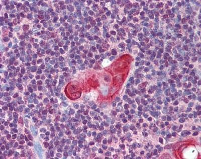 Anti-HOX11 (aa300-330) Antibody