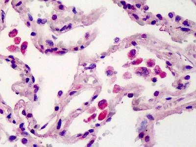 Anti-Porimin (aa173-188) Antibody
