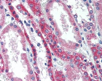Anti-RANK (aa603-613) Antibody