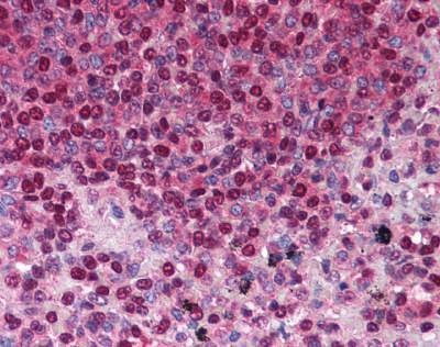 Anti-TACI (aa116-132) Antibody