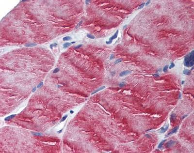 Anti-MYO5B / Myosin VB (N-term) Antibody