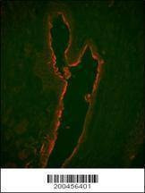 Anti-LTF Antibody