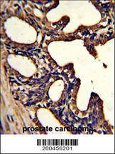 Anti-LTF Antibody