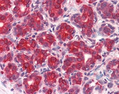 Anti-GM2A (Internal) Antibody