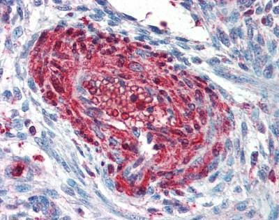 Anti-FSP1 / S100A4 (C-term) Antibody