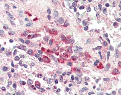Anti-TREM2 (C-term) Antibody