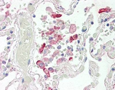 Anti-Carboxylesterase 1 (Internal) Antibody