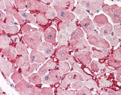 Anti-Aspartate Aminotransferase (aa157-167) Antibody