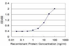 Anti-ALAS2 Antibody