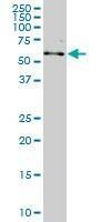 Anti-ALAS2 Antibody