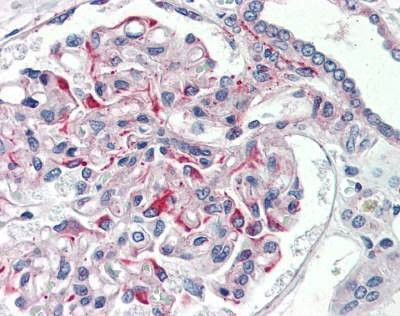 Anti-Jagged1 / Jagged (aa110-125) Antibody