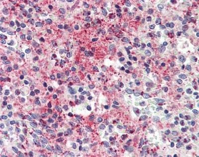 Anti-CCL5 / RANTES Antibody
