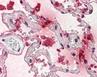 Anti-TPSAB1 Antibody