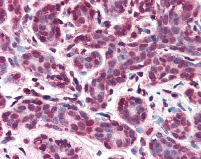 Anti-IPO7 / RANBP7 (C-term) Antibody