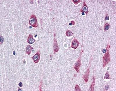 Anti-RAPSYN (C-term) Antibody