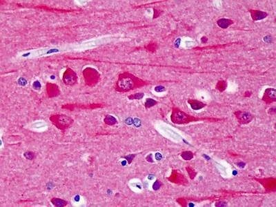 Anti-Rat CAMK2 (pThr286) Antibody