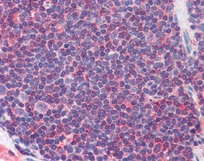Anti-Mouse IL7R / CD127 (pTyr449) Antibody