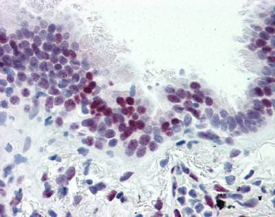 Anti-CASZ1 (N-term) Antibody