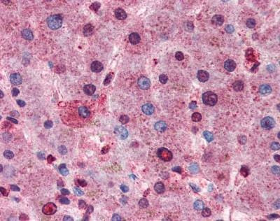 Anti-AKT1/2/3 (C-term) Antibody