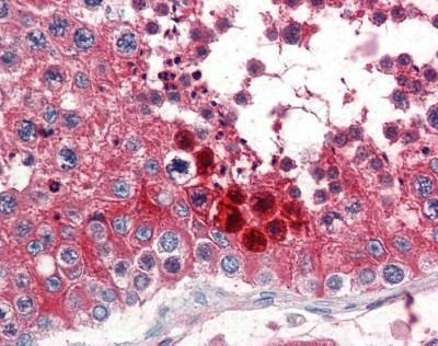 Anti-Clusterin (C-term) Antibody