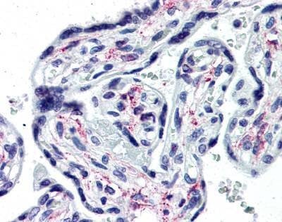 Anti-IL1RA / IL1R1 (Extracellular Domain) Antibody