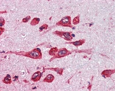 Anti-Monoamine Oxidase B (Internal) Antibody