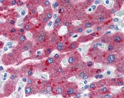 Anti-CFH / Factor H Antibody
