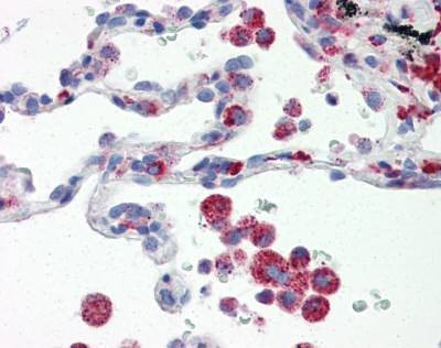 Anti-IRF7 (aa1-150) Antibody