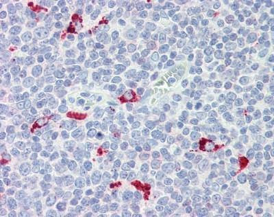 Anti-IRF7 (aa1-150) Antibody