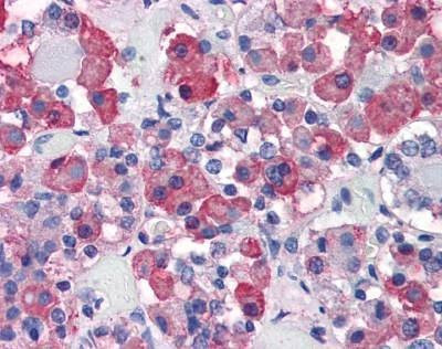 Anti-Growth Hormone Antibody