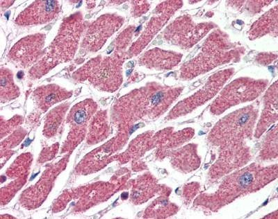 Anti-CPT1 / CPT1A (Internal) Antibody
