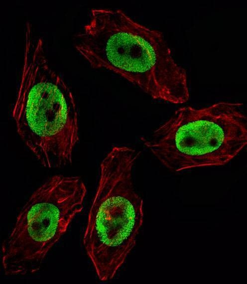 Anti-EZH2 Antibody