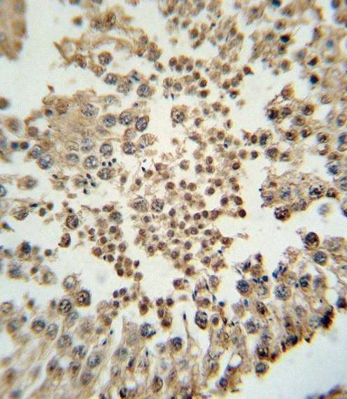 Anti-EZH2 Antibody