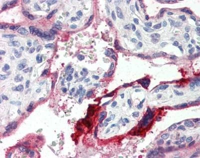 Anti-Annexin A1 / Annexin I (C-term) Antibody
