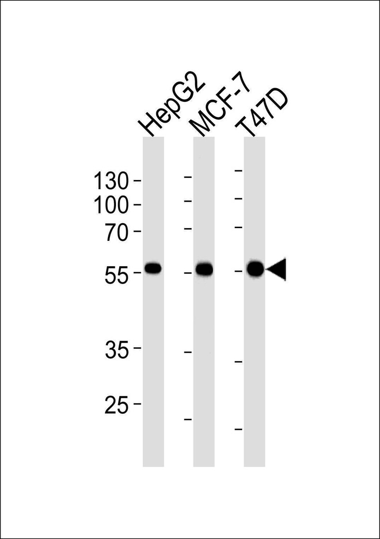 Anti-ALDH6A1 Antibody
